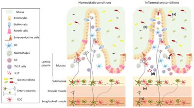 The Gut-Brain Axis in Multiple Sclerosis. Is Its Dysfunction a Pathological Trigger or a Consequence of the Disease?